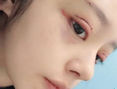换头手术小姐姐怎么做,小姐姐的奇迹重生之路